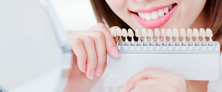 ホワイトニング