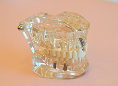 03 痛みや不安に配慮した診療方針